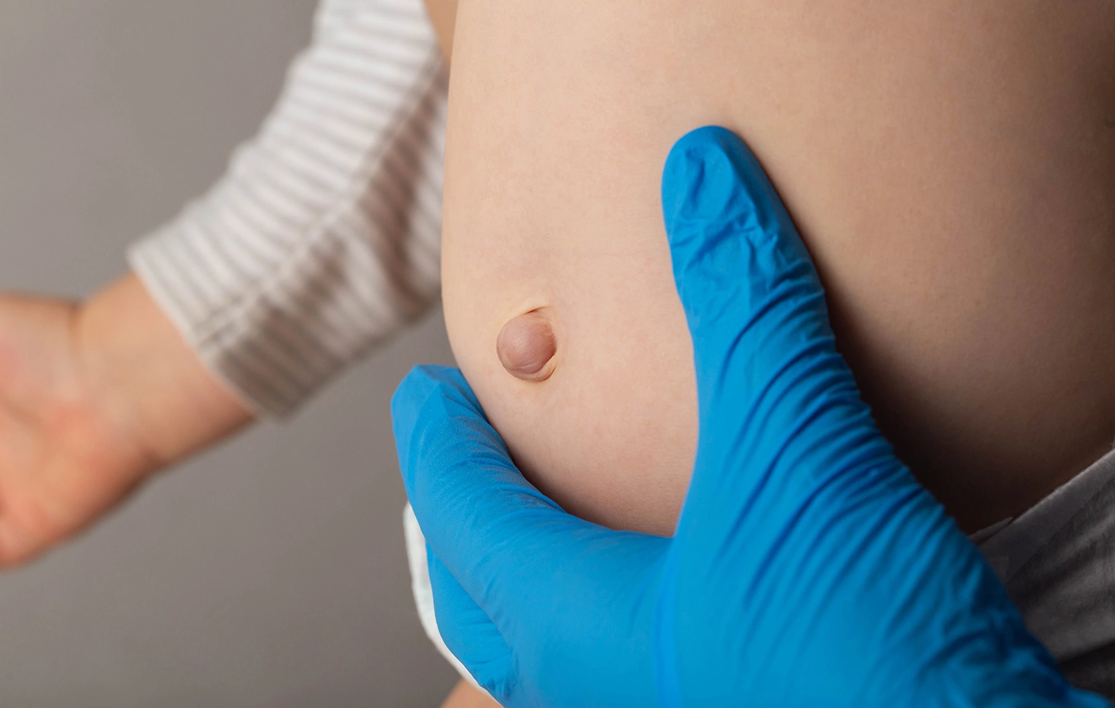 Hernia in Babies and Children: Should You Be Worried?