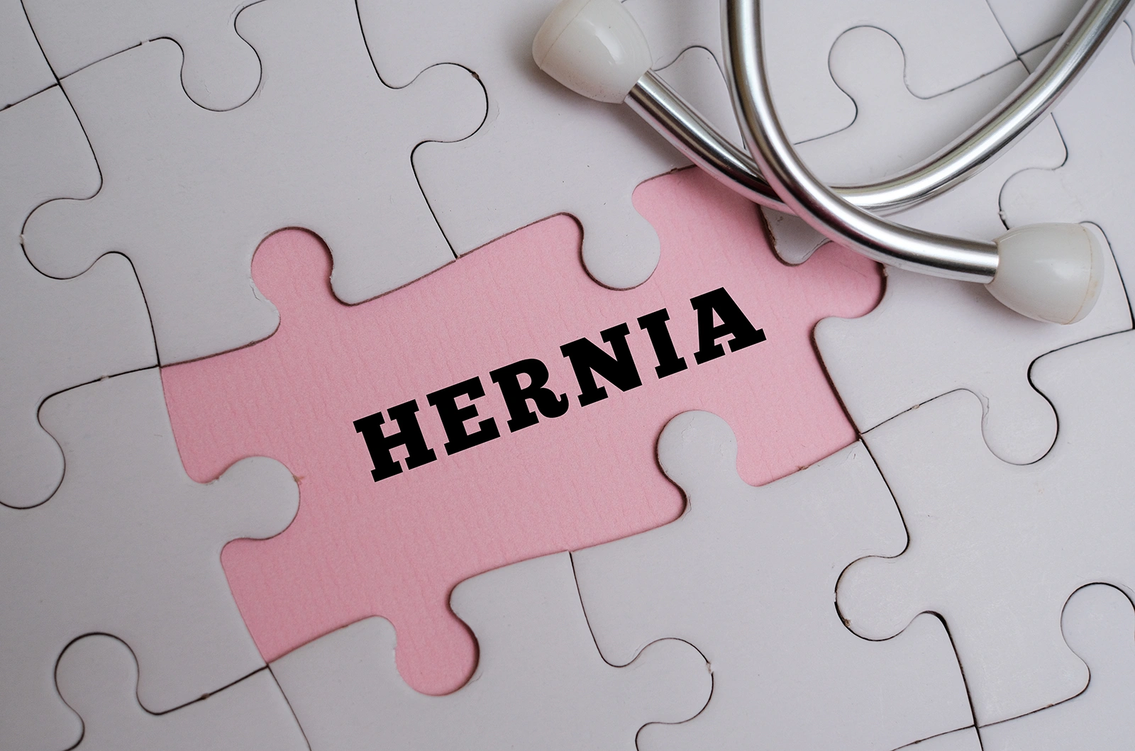 Which Imaging Test is Best for Hernia Diagnosis?