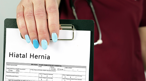 What Is a Hiatal Hernia?